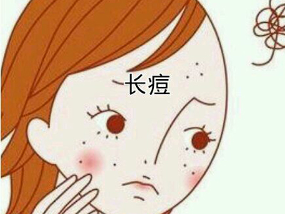 预防痘痘的6大妙招