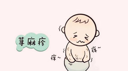 荨麻疹的典型症状表现